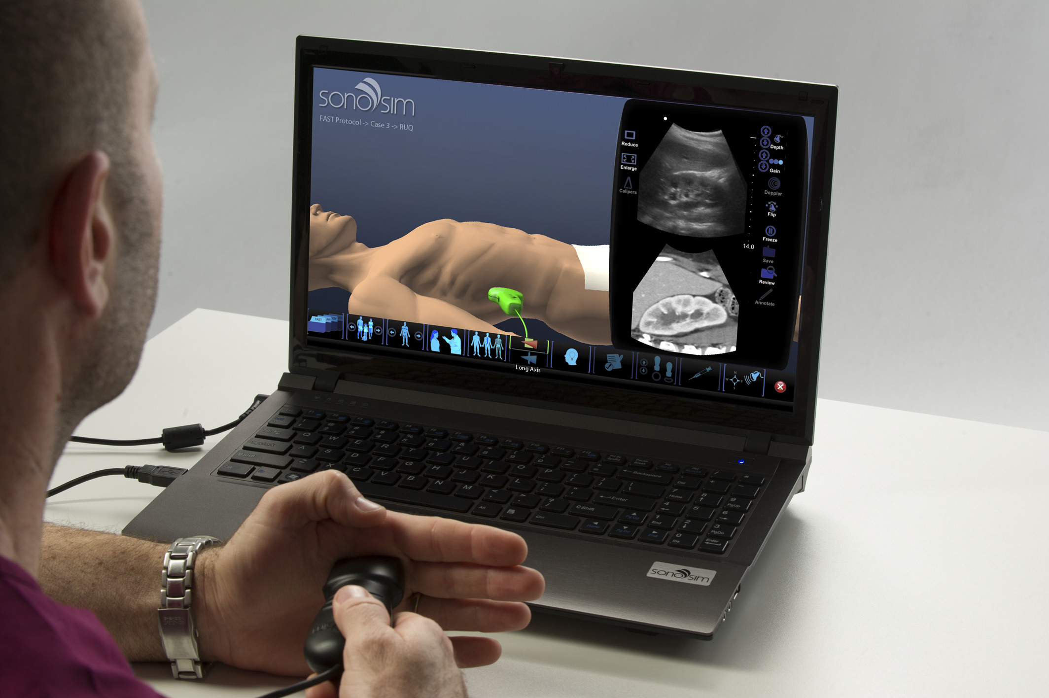 SonoSim Ultrasound Training Modules Approved for CME Credit